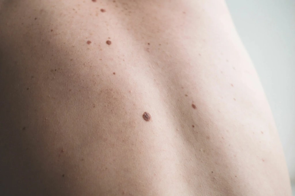 Entrada sin título 5999